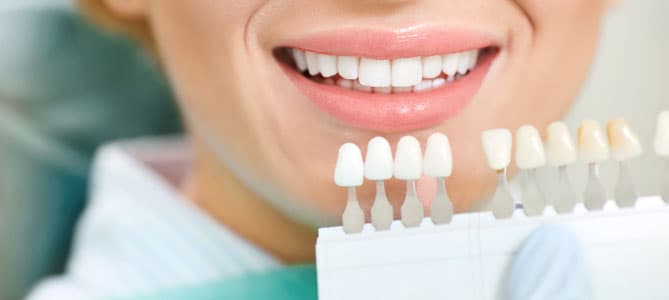 Close-up of woman's smile with porcelain veneer shade guide held up for comparison