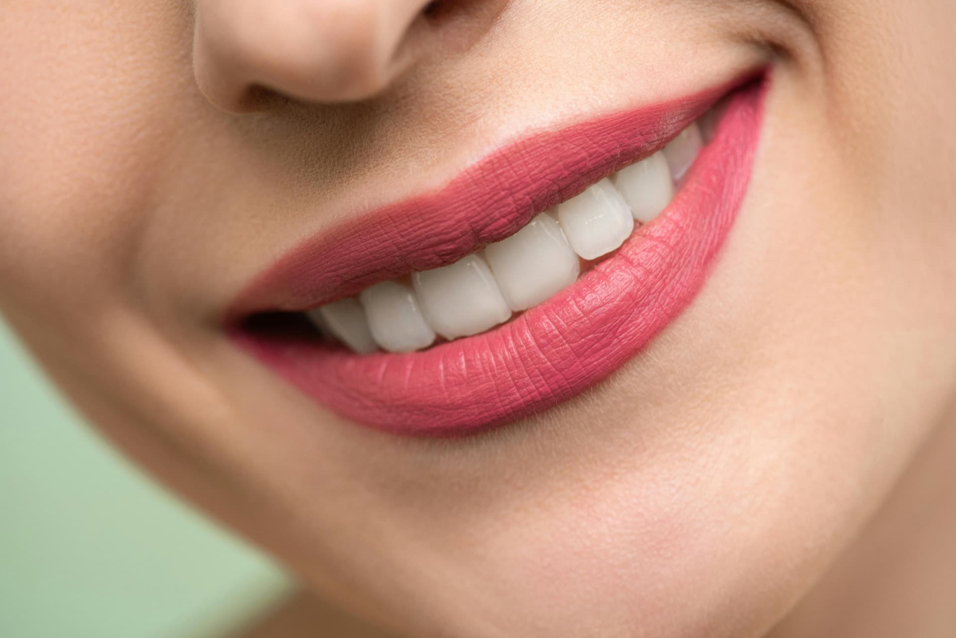 Woman with a bright, white smile after teeth whitening