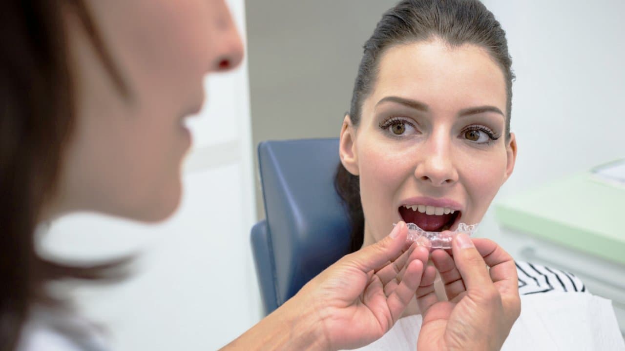 Benefits of Invisalign clear aligners for teeth straightening