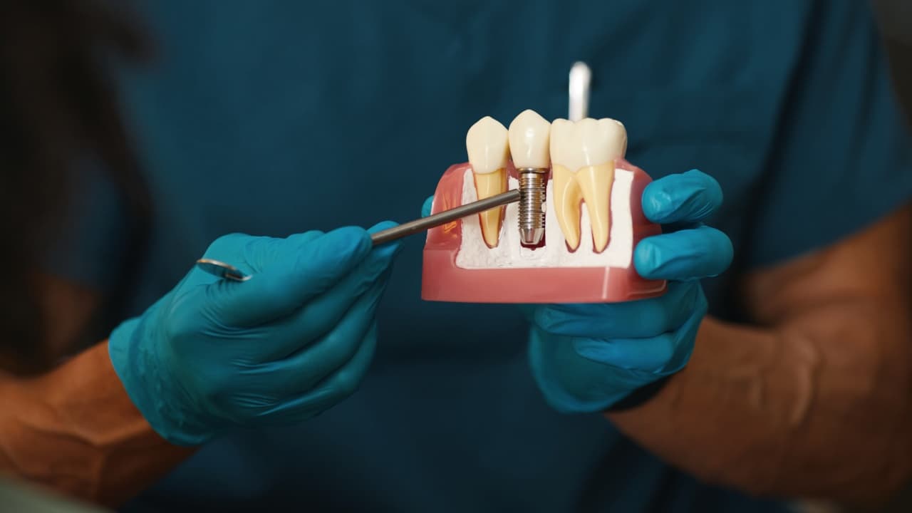 Dental professional holding a jaw model with dental implant cross-section visible