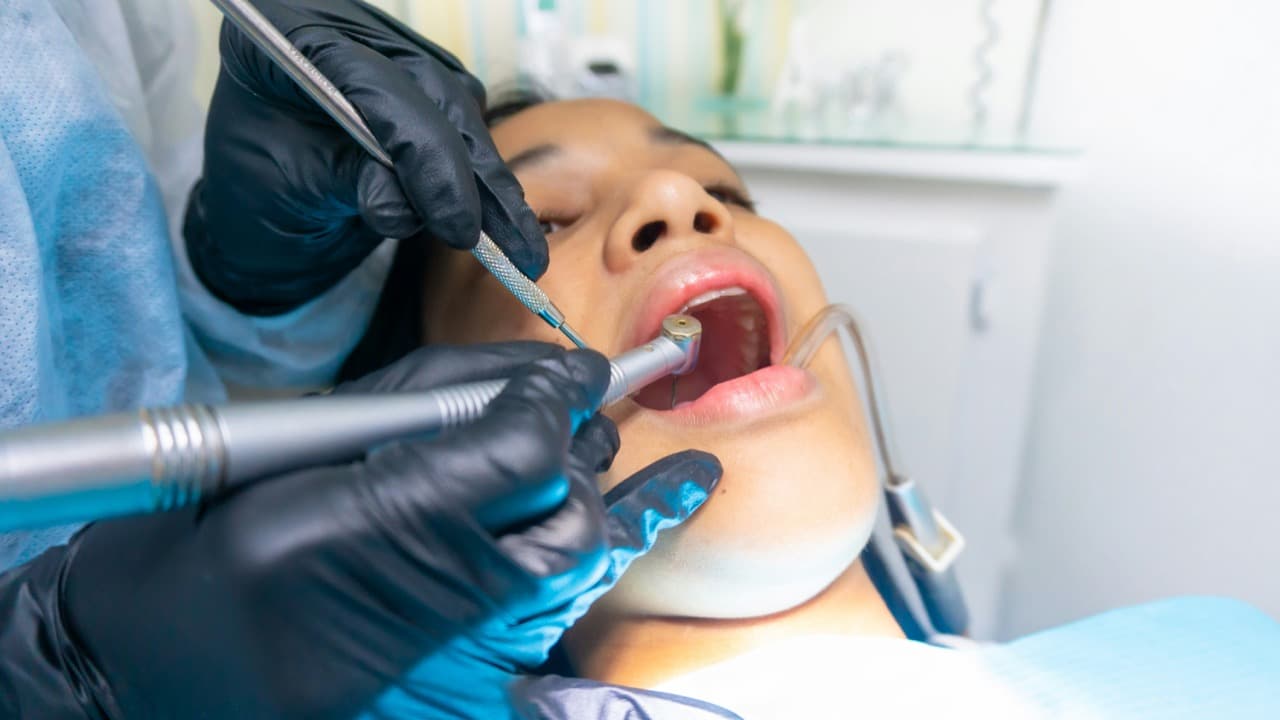 Patient receiving professional dental scaling to remove tartar buildup
