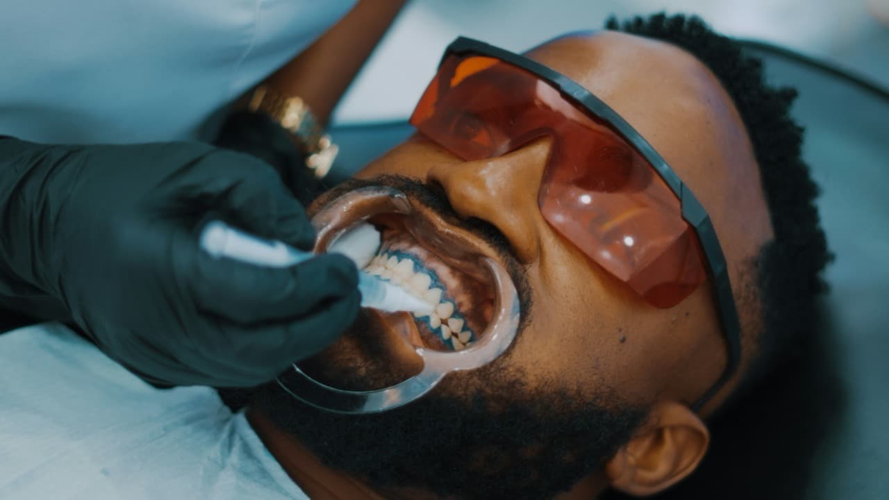 Close-up of a man receiving dental polishing with a rotary tool at a dental office