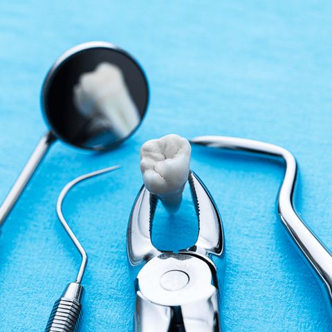 Why Regular Dental Visits are Important: Protecting Your Health Through Preventive Care
