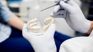 Types of Retainers