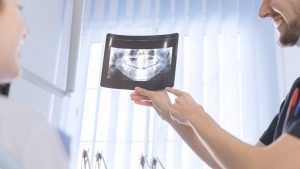 tooth replacement options