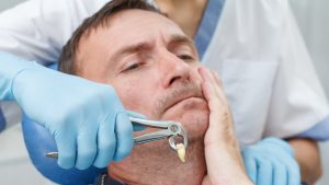 Dental Implant Risks How to Prevent Complications
